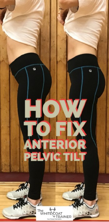 how to fix anterior pelvic tilt: brittany standing with an excessive arch in her lower back and also showing a normal lower back curve