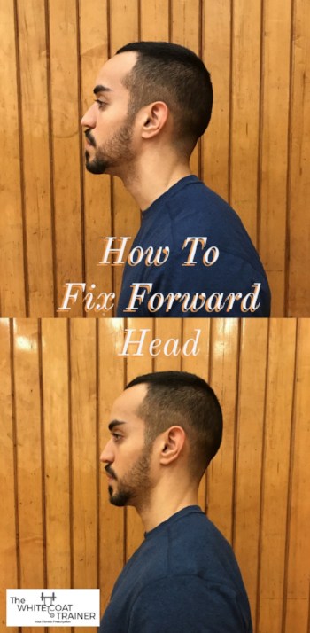 how to tell if you have bad posture forward head: alex standing with his chin up and neck arched up- his ears are not in line with his shoulders on a side view